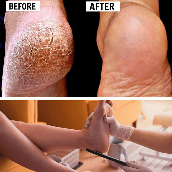 FootFile, dokonalý pilník pro ruční pedikúru - Image 7