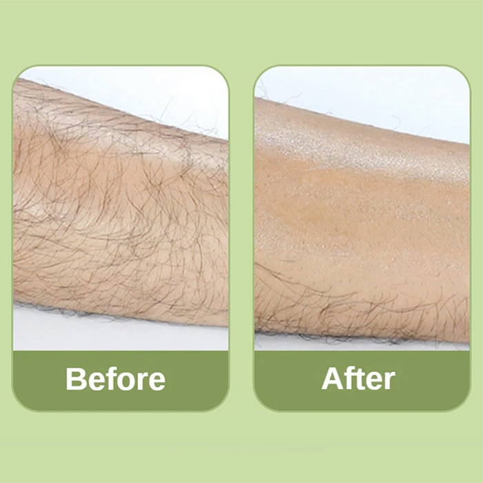 SoftSkin, krystalový odstraňovač chloupků, který snižuje a zpomaluje růst chloupků - Image 5