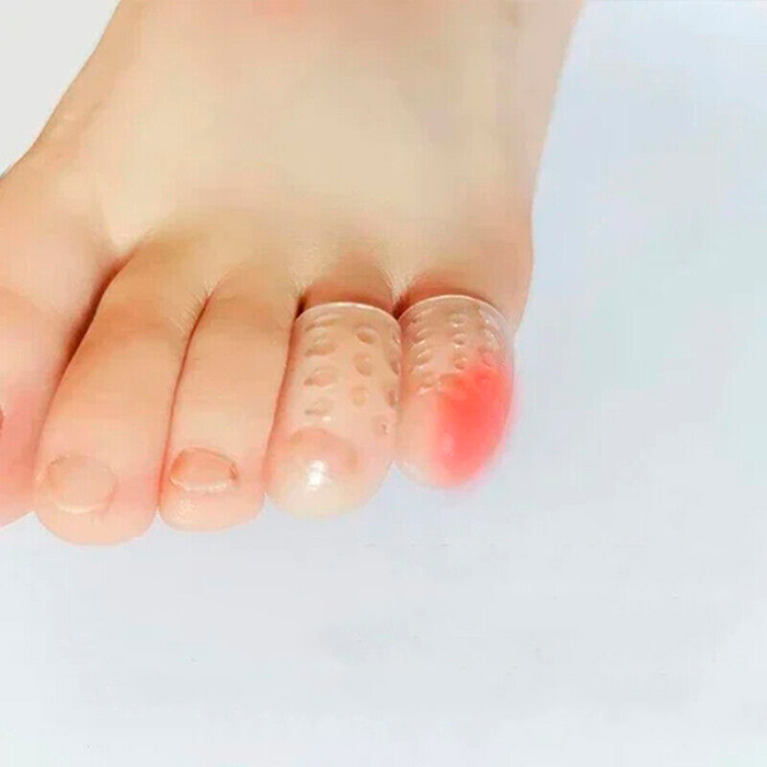 ToeProtector, silikonový chránič prstů (10 kusů) - Image 8
